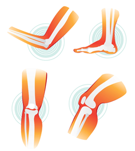 Exercise regimen helps improve range of motion, reduce joint pain, prevent atrophy, builds muscle